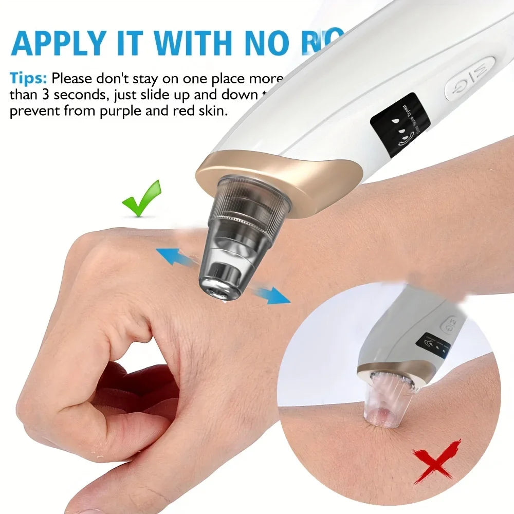Blackhead Remover Pore Vacuum - 5 Suction Modes USB Rechargeable Facial Pore Cleaner Kit